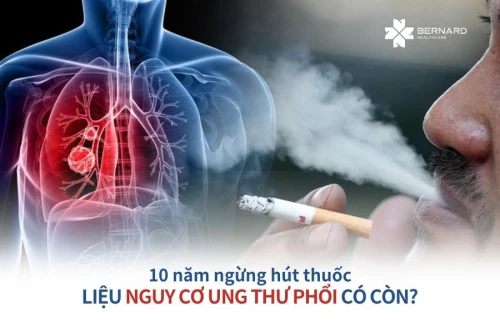 10 năm ngừng hút thuốc, liệu rằng nguy cơ ung thư phổi có còn?